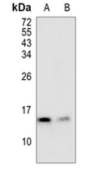 SAA4 Rabbit Monoclonal Antibody
