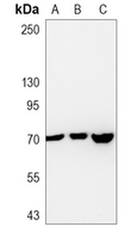 EPHX2 Rabbit Monoclonal Antibody