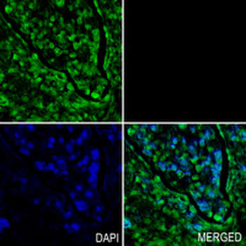 EPHX2 Rabbit Monoclonal Antibody
