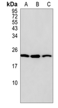 AK4 Rabbit Monoclonal Antibody
