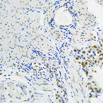 hnRNP I Rabbit Monoclonal Antibody