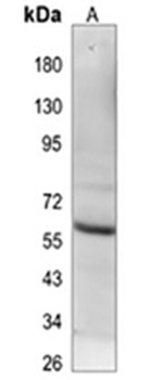 EGR-1 Rabbit Monoclonal Antibody