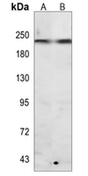 Myosin Heavy Chain 6/7 Rabbit Monoclonal Antibody