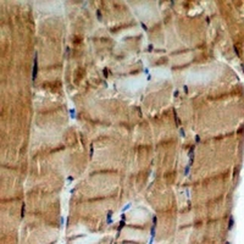 Myosin Heavy Chain 6/7 Rabbit Monoclonal Antibody