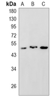 HAPLN1 Rabbit Monoclonal Antibody