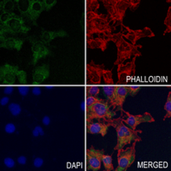 HAPLN1 Rabbit Monoclonal Antibody