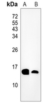 MGST1 Rabbit Monoclonal Antibody