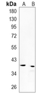 CD63 Rabbit Monoclonal Antibody