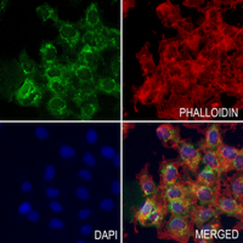 ANP Rabbit Monoclonal Antibody