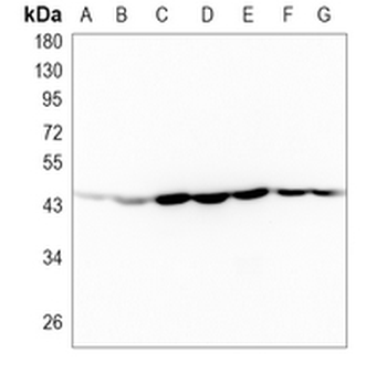 PGK1 Rabbit Monoclonal Antibody