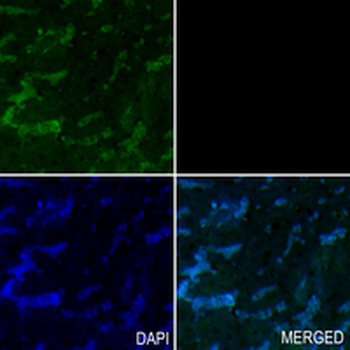 PGK1 Rabbit Monoclonal Antibody
