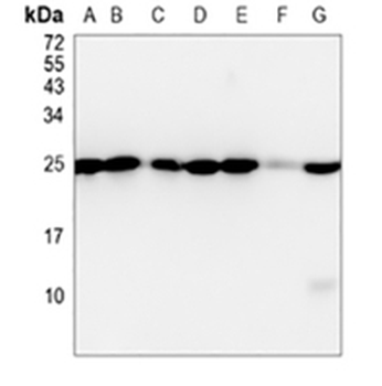 HPRT Rabbit Monoclonal Antibody