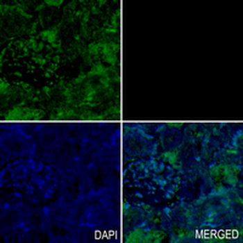 HPRT Rabbit Monoclonal Antibody