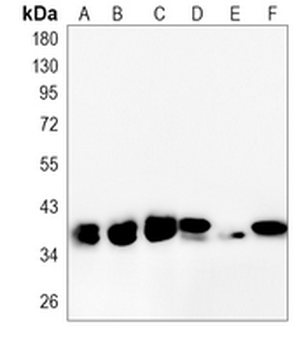 LDHA Rabbit Monoclonal Antibody