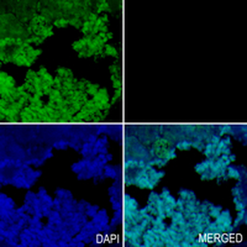 LDHA Rabbit Monoclonal Antibody