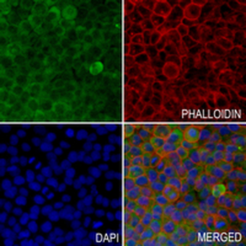LDHA Rabbit Monoclonal Antibody