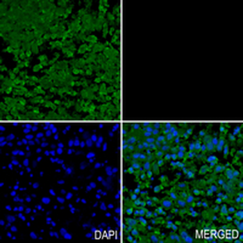 SEC24D Rabbit Monoclonal Antibody