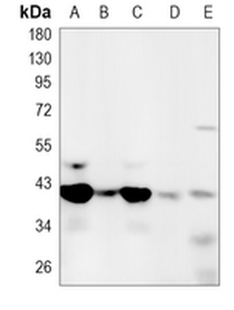 MacroH2A1 Rabbit Monoclonal Antibody