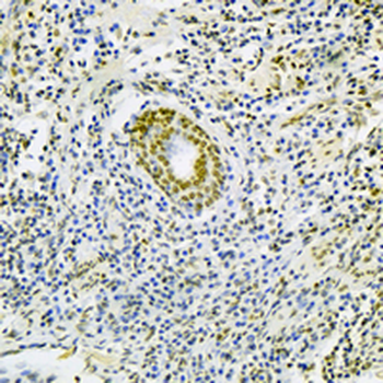 MacroH2A1 Rabbit Monoclonal Antibody