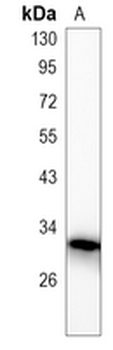 PP6 Rabbit Monoclonal Antibody