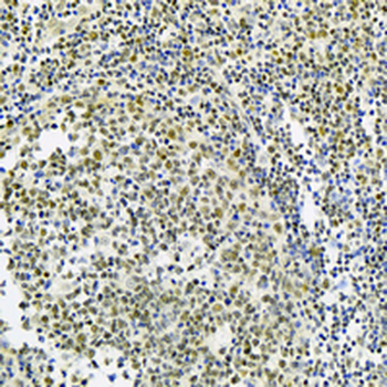 SMCHD1 Rabbit Monoclonal Antibody