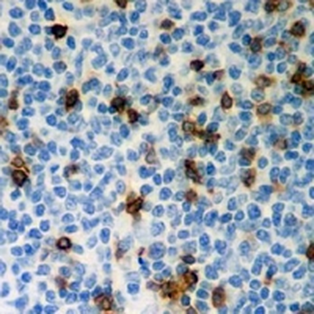 CD103 Rabbit Monoclonal Antibody
