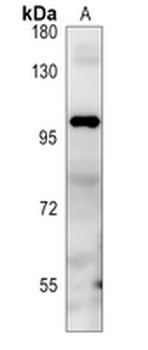 Thyroid Peroxidase Rabbit Monoclonal Antibody