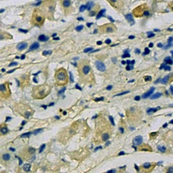 GAB1 Rabbit Monoclonal Antibody