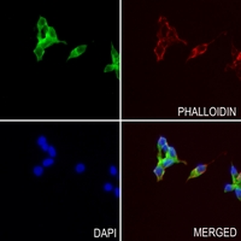 GAB1 Rabbit Monoclonal Antibody