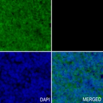 GAB1 Rabbit Monoclonal Antibody
