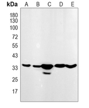 PEX7 Rabbit Monoclonal Antibody