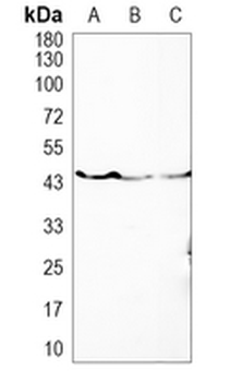 PSMC5 Rabbit Monoclonal Antibody