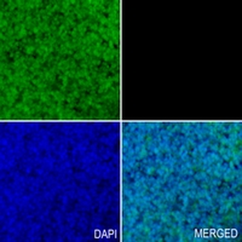 PSMC5 Rabbit Monoclonal Antibody