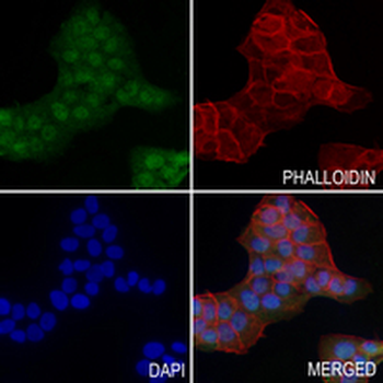 PSMC5 Rabbit Monoclonal Antibody
