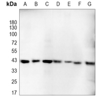 p38 Rabbit Monoclonal Antibody