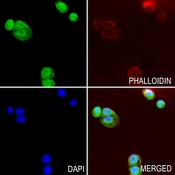 p38 Rabbit Monoclonal Antibody
