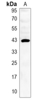 HA-tag Rabbit Monoclonal Antibody