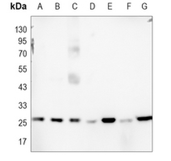 BCL2 Rabbit Monoclonal Antibody