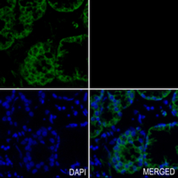 BCL2 Rabbit Monoclonal Antibody