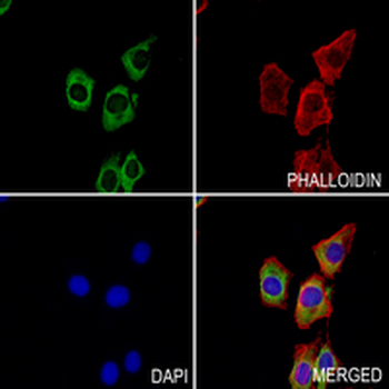BCL2 Rabbit Monoclonal Antibody