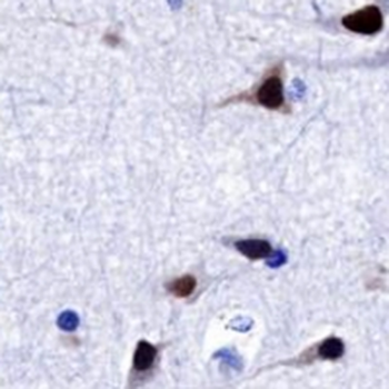 SATB2 Rabbit Monoclonal Antibody