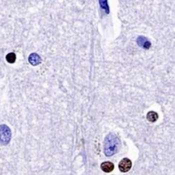 SOX10 Rabbit Monoclonal Antibody