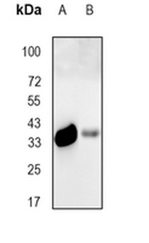 Calponin 1 Rabbit Monoclonal Antibody