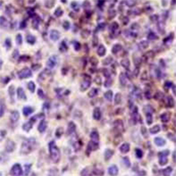 VPAC2 Rabbit Monoclonal Antibody