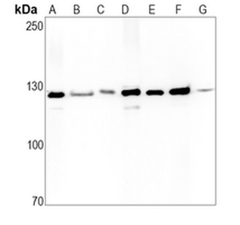 Vinculin Rabbit Monoclonal Antibody