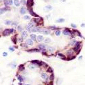 Vinculin Rabbit Monoclonal Antibody