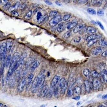 Villin Rabbit Monoclonal Antibody