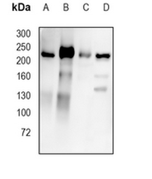 VEGFR2 Rabbit Monoclonal Antibody