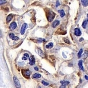 VEGFR2 Rabbit Monoclonal Antibody