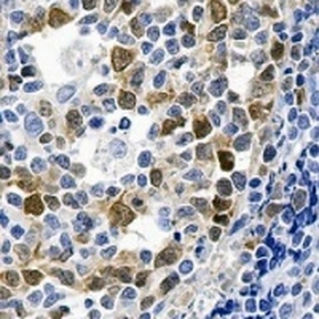 Thymidylate Synthase Rabbit Monoclonal Antibody